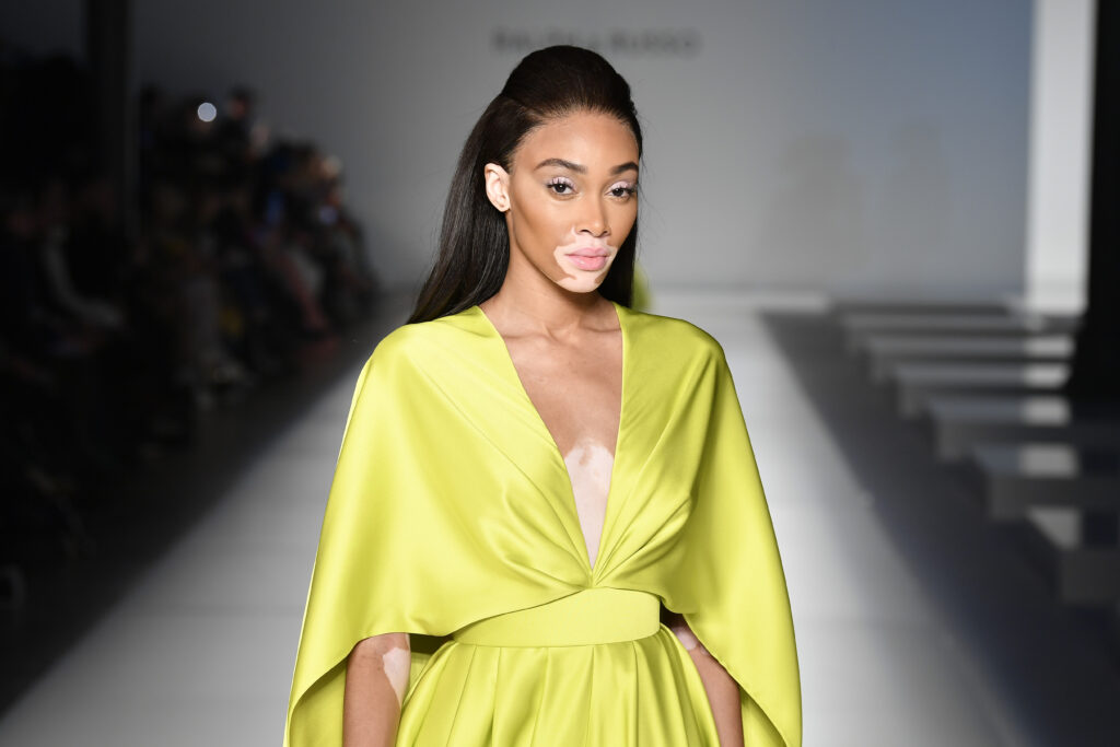 winnie harlow