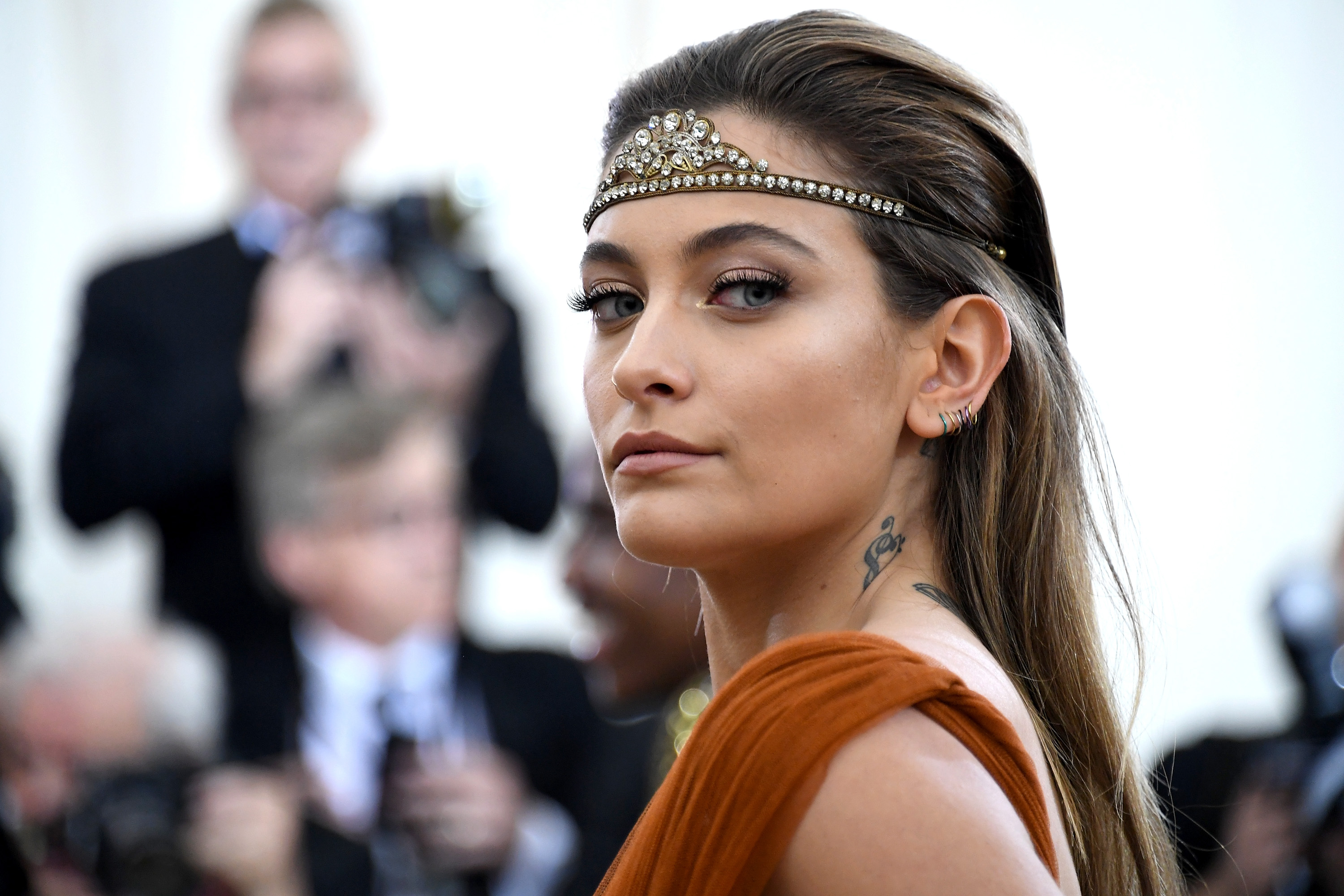 Paris Jackson Underwent Surgery To Remove "Golf Ball" Abscess
